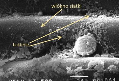 bakterie na powierzchni siatki bakterie na powierzchni siatki