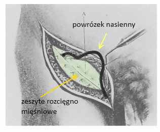 potemski2
